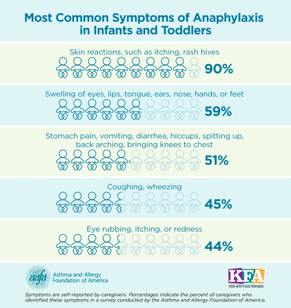 A chart showing the most common symptoms of anaphylaxis in infants and toddlers with percentages of how often they occur